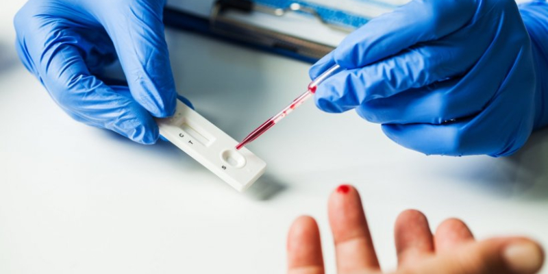 Etichettatura ambientale degli imballaggi